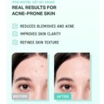 Bring Green Tea Tree Cica Soothing Cream Plus 100ml - Image 4