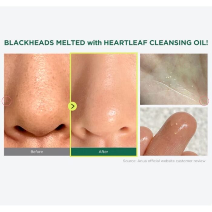 Anua Heartleaf Cleasing Oil 200ml and Cleansing Form 150ml - Image 7