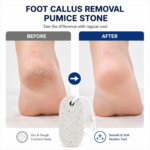 Foot Callus Removal Pumice Stone - Image 3